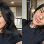 Shafa Harris Open Revision Rhinoplasty