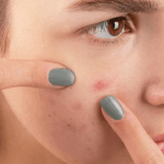 Kandungan Skincare