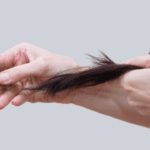 Penyebab Rambut Rontok