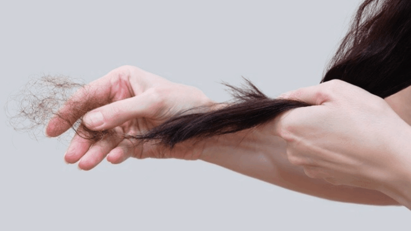Penyebab Rambut Rontok
