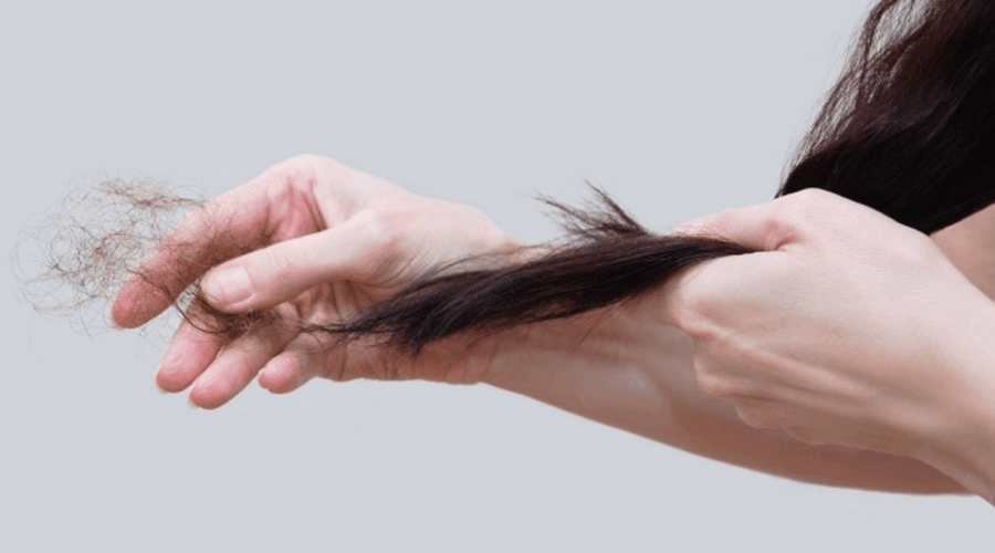 Penyebab Rambut Rontok
