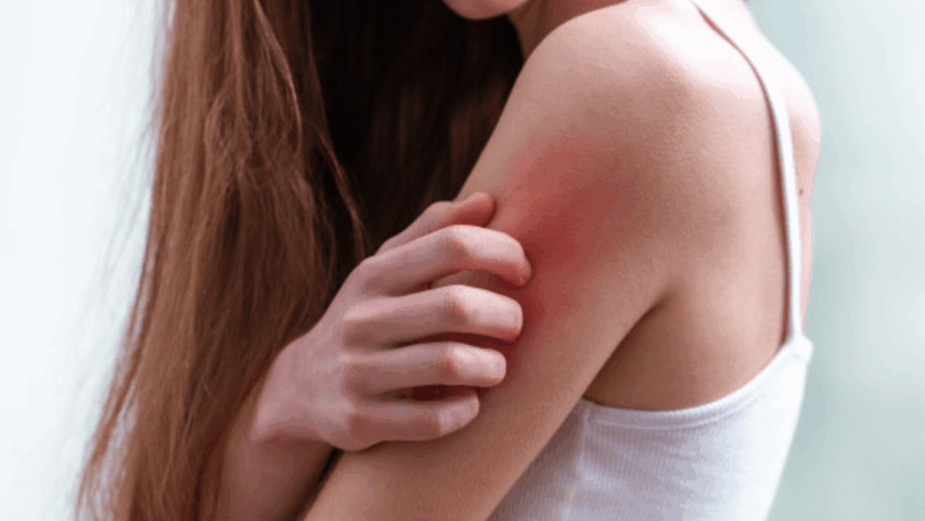 Penyebab Kulit Sensitif