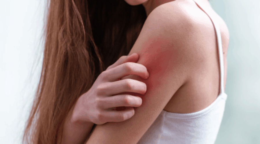 Penyebab Kulit Sensitif