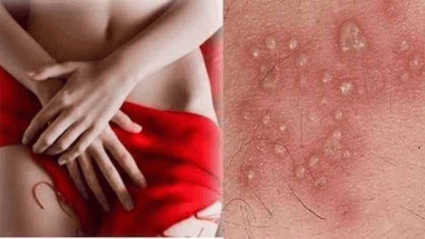 Penyebab Vagina Gatal