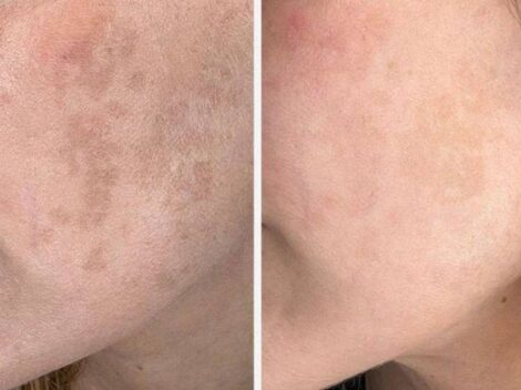 Serum