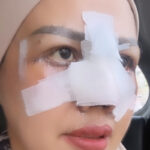 Ilustrasi elly sugigi oplas untuk artikel Elly sugigi oplas: Elly Sugigi Jalani Oplas Hidung dan Mata,…