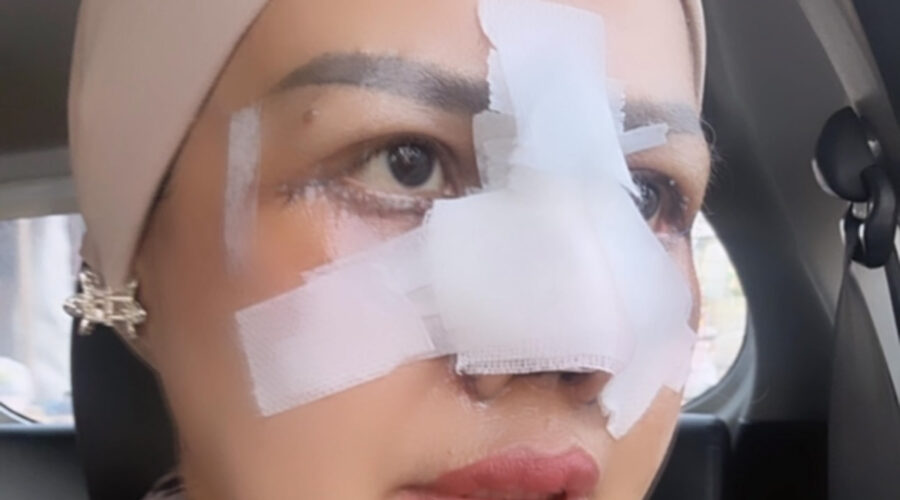 Ilustrasi elly sugigi oplas untuk artikel Elly sugigi oplas: Elly Sugigi Jalani Oplas Hidung dan Mata,…