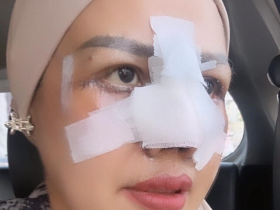Ilustrasi elly sugigi oplas untuk artikel Elly sugigi oplas: Elly Sugigi Jalani Oplas Hidung dan Mata,…